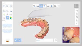 The image displays a computer screen with a 3D rendering of a tooth, showcasing its anatomy and internal structure, likely for educational or dental analysis purposes.