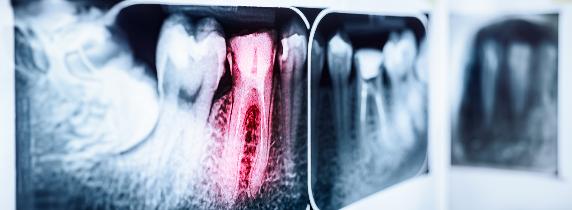 The image is a collage of three photographs. On the left, there s an X-ray showing a human tooth with a cavity. In the center, there s a close-up of a person s face from the nose up, and on the right, there s a photo of a person s chest with a medical device attached to it.