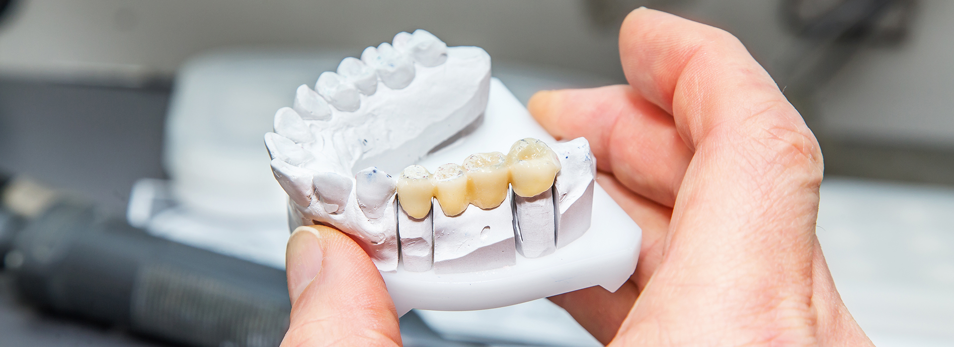 An individual is holding a white dental model with multiple teeth, possibly for educational or demonstration purposes.