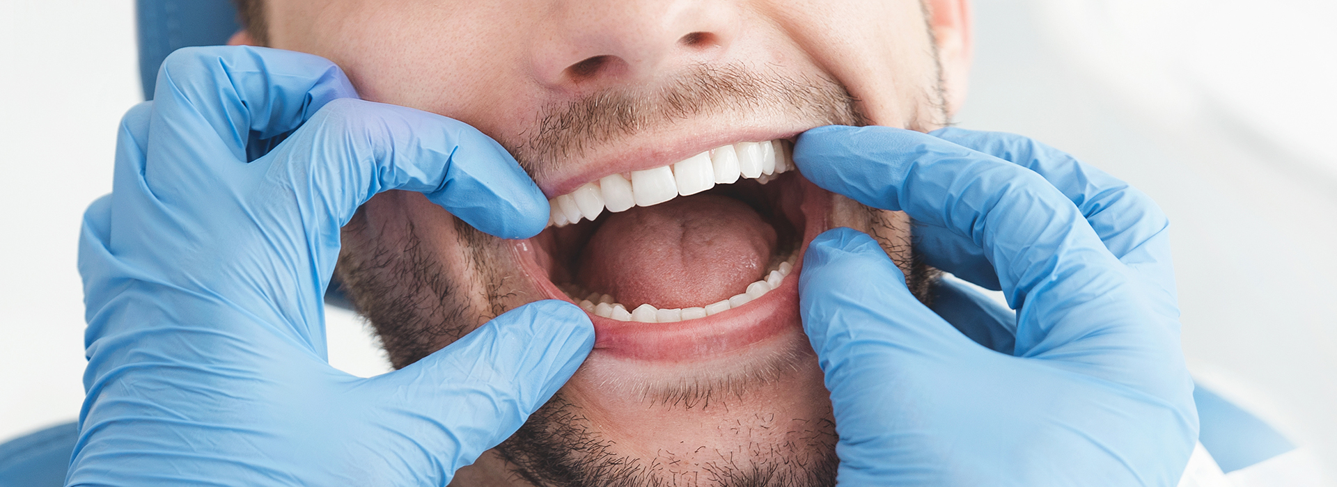 A man in a dental mask holding his mouth open with one hand.