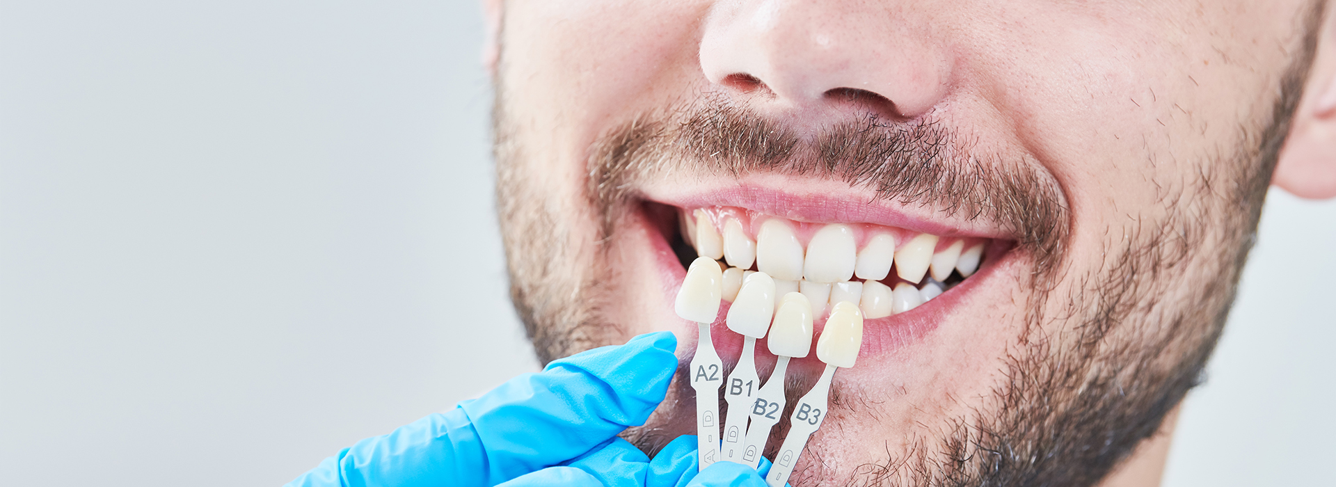 The image shows a person with a toothy smile, wearing a blue surgical mask and holding a dental implant with a visible root structure.