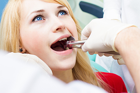 A woman receiving dental care, with her mouth open wide and a dentist working on her teeth.