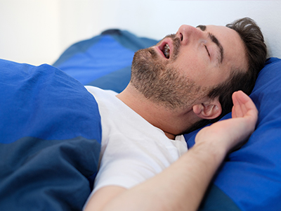 A man is lying in bed with his head on a pillow, appearing to be asleep or resting.